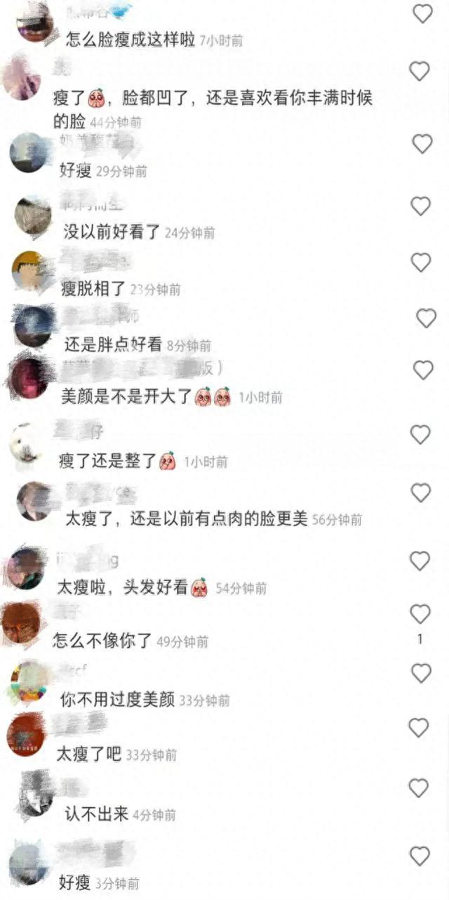 34岁的张雨绮被质疑整容，双颊凹陷让人认不出，被质疑整容了？