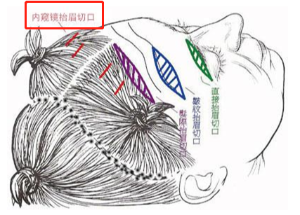 养成式超模的颜值逆袭，网红贝拉是如何一步步进阶成为超模的