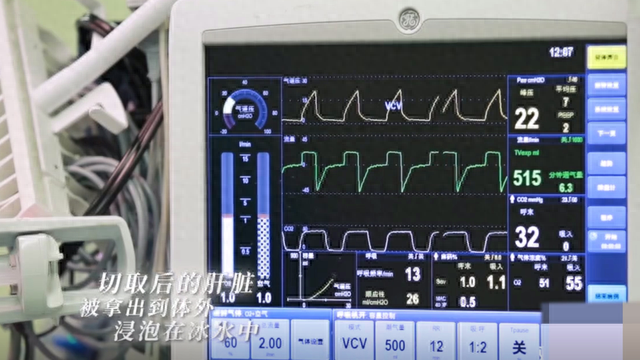 2019年，一花季少女因不良习惯身染虫癌，医生开刀竟发现2斤虫子