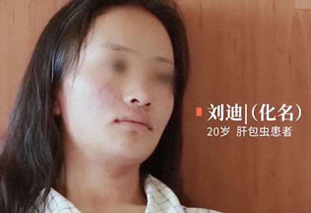 2019年，一花季少女因不良习惯身染虫癌，医生开刀竟发现2斤虫子