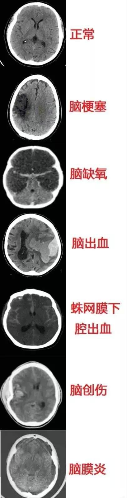 完整版神经系统医学美图看一眼就可以记住