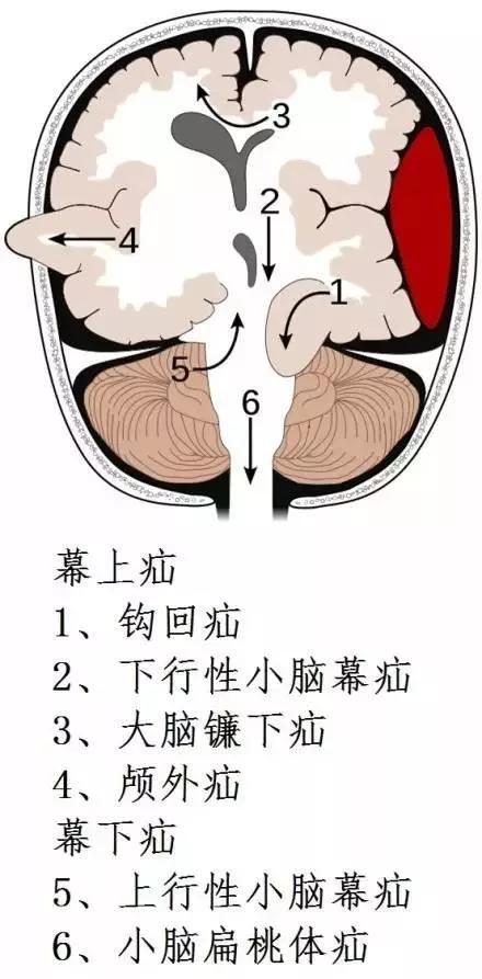 完整版神经系统医学美图看一眼就可以记住