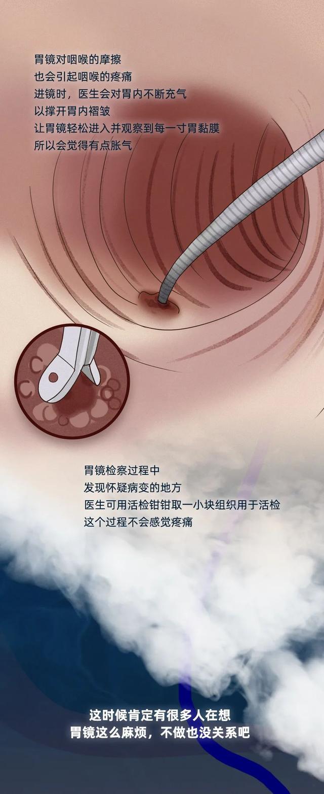 胃镜检查全过程演示，看完你还会怕吗？