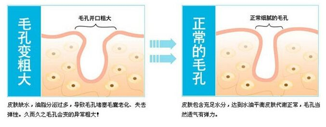 美女脸上“爬出虫子”，医生检查说出的话令人反胃，父母当场崩溃