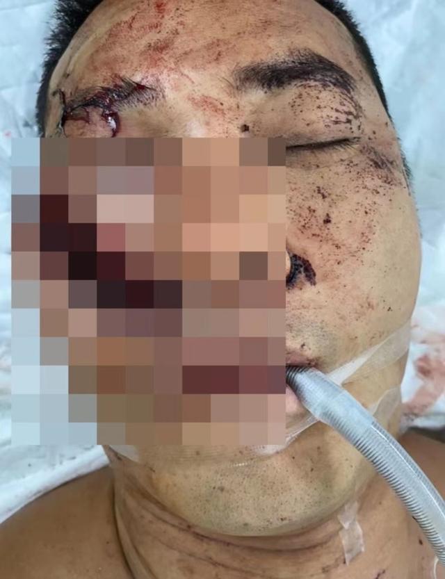 遇袭案判结！港男星揭被砍真相，行凶者混淆电影与现实而萌生杀意