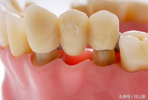 图解补牙、矫正牙齿、修补蛀牙的常见牙科用具，看看你见过几个？