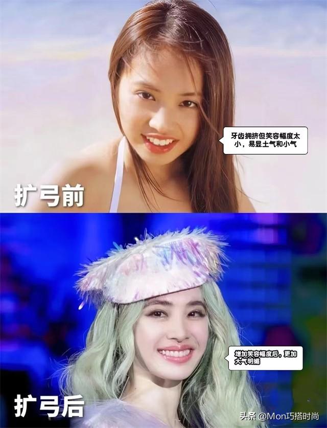 一个女人好不好看，看她的“牙齿”就知道了，差别不是一般的大