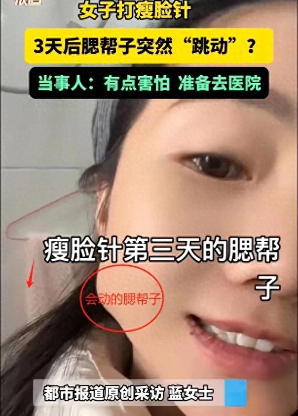 打瘦脸针获“腮帮舞”新技能？女子经历引热议