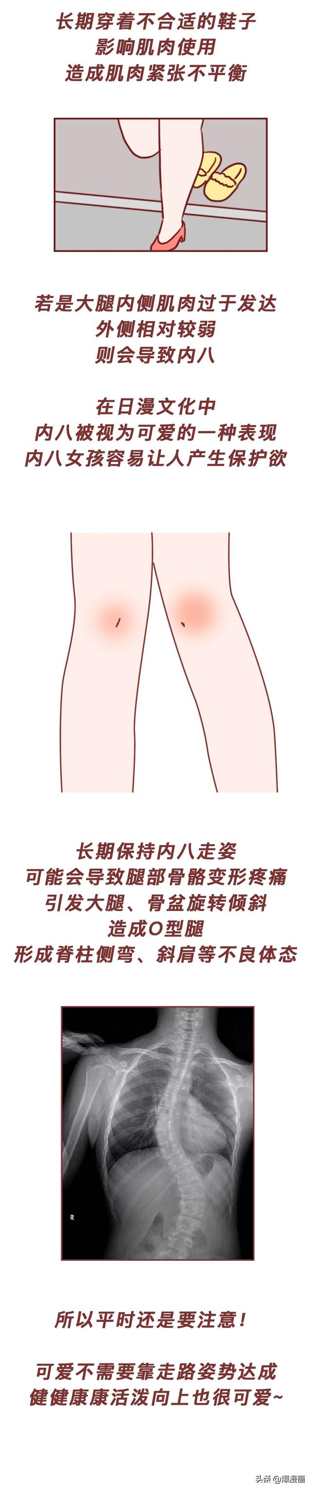 为什么有些女生喜欢夹紧大腿走路？揭露这样走路的底层原因